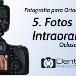 foto set ortodoncia