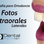 fotografia de diagnostico en ortodoncia