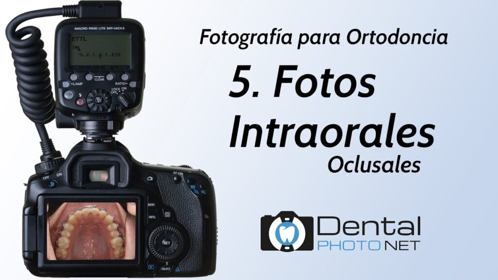 fotografia dental ortodoncia en clinica