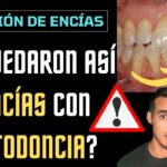 fotografias cientificas recesiones gingivales y ortodoncia