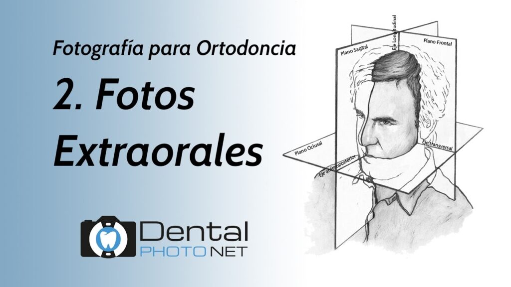 fotos extraorales ortodoncia