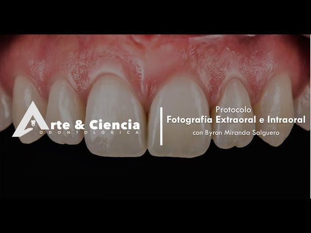fotos intraorales y extraorales ortodoncia odontologia