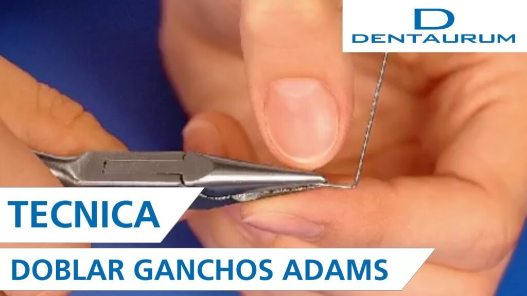 ganchos adams para ortodoncia removible