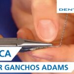 ganchos adams para ortodoncia removible