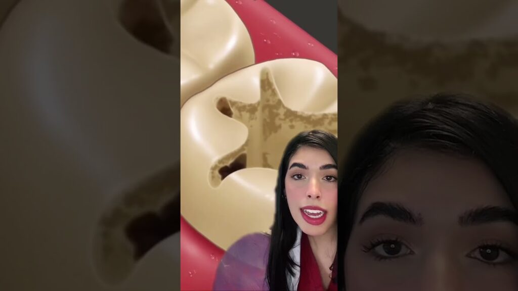 gif animado de dientes ortodoncia