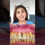 gloria dentista ortodoncia