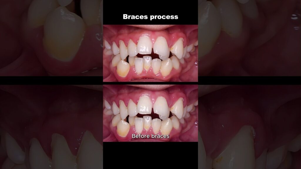 healthy mouth ortodoncia