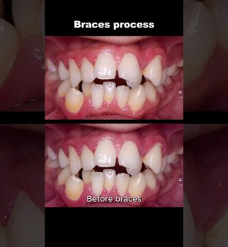 healthy mouth ortodoncia