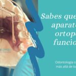 ibro alio ortodoncia y ortopedia con aparatos funcionales