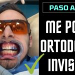 imagenes de apratotos de ortodoncia