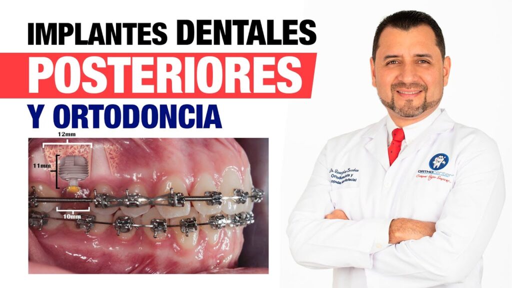 implantes dentales ortodoncia