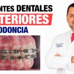 implantes dentales ortodoncia