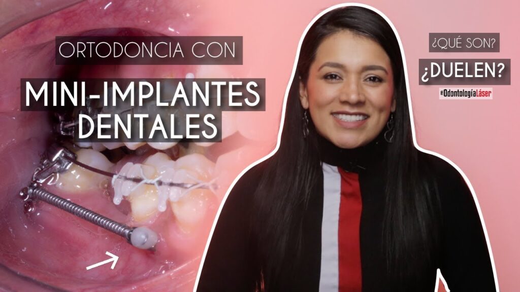 implantes escuela de ortodoncia