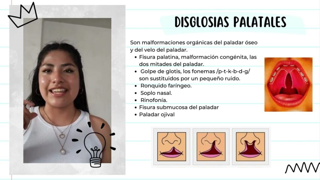 intevencion ortodoncia disglosia palatales