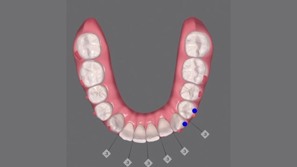 invalsigin ortodoncia