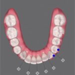 invalsigin ortodoncia