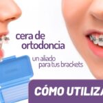 la cera de ortodoncia se puede reutilizar