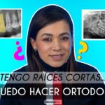 la ortodoncia debilita las raices