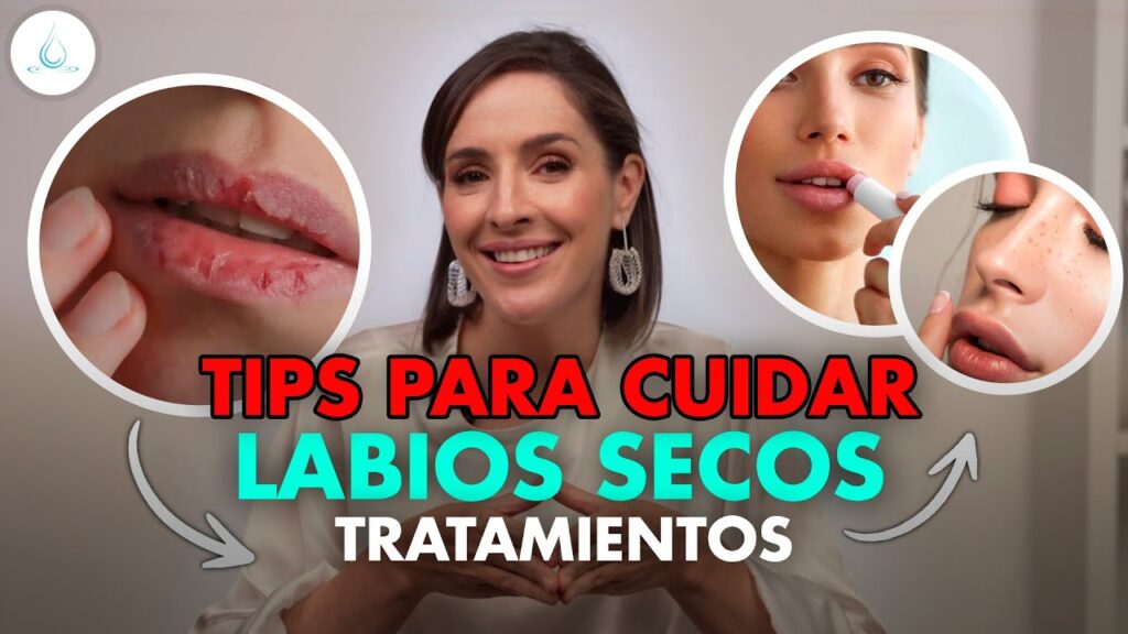 labios mas resecos ortodoncia