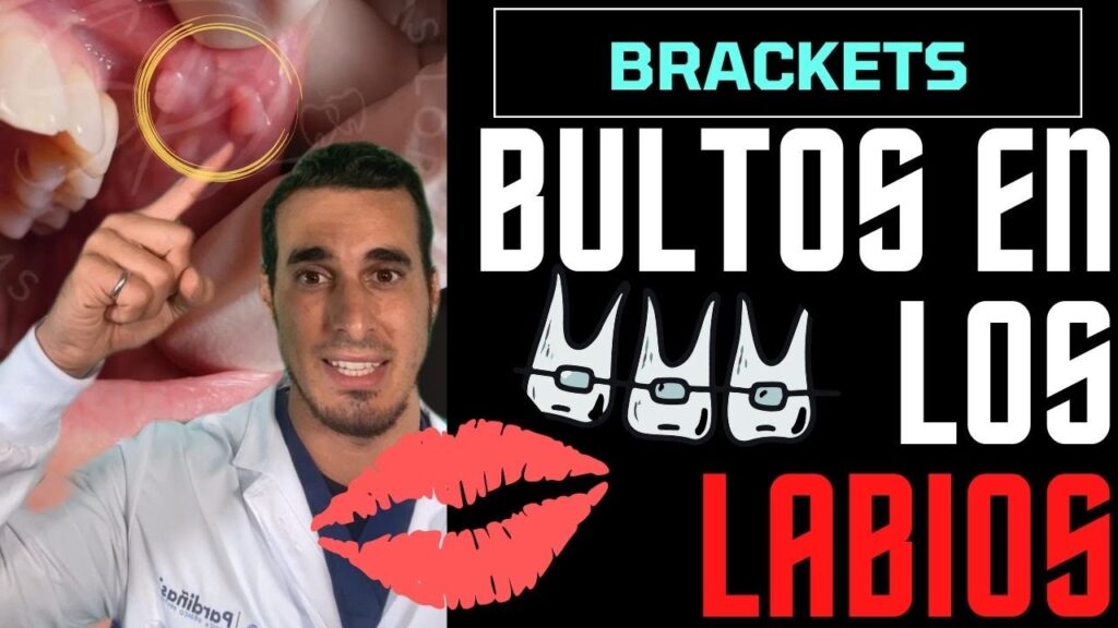 lesion en los labios por ortodonci