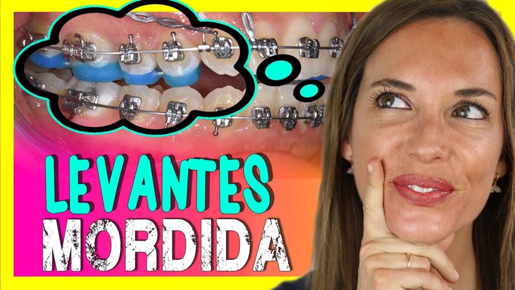 levantes ortodoncia