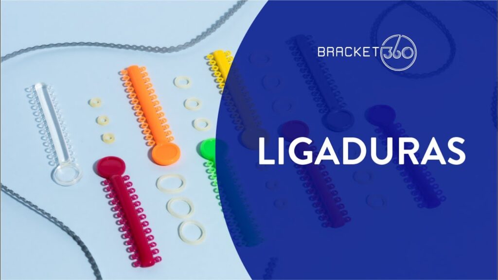 ligaduras ortodoncia comprar