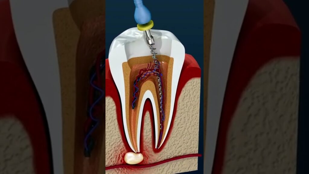 longitud de corona clinica tras protrusion ortodoncia