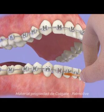 los mejores productos para ortodoncia