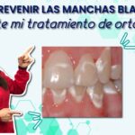 manchas blancas en aparato ortodoncia