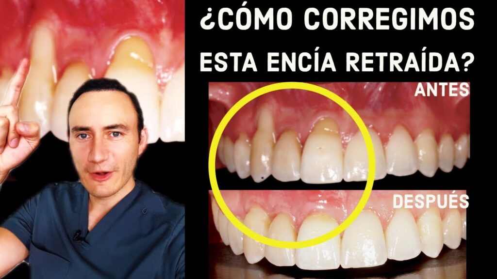 me hicieron cirugia periodontal para despues llevar ortodoncia