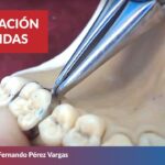 medir bandas de ortodoncia