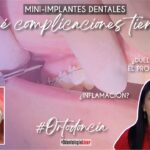 microimplante ortodoncia se cae