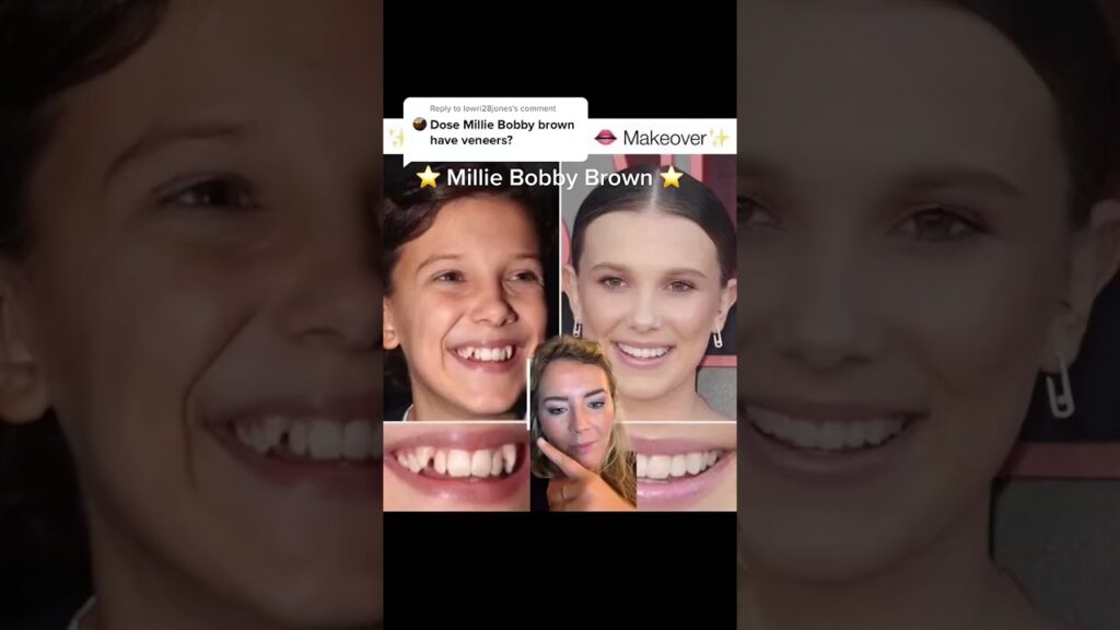 millie bobby brown ortodoncia