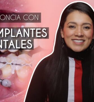 mini implantes en ortodoncia pdf