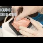 modelos de ortodoncia en yeso descripcion procedimiento