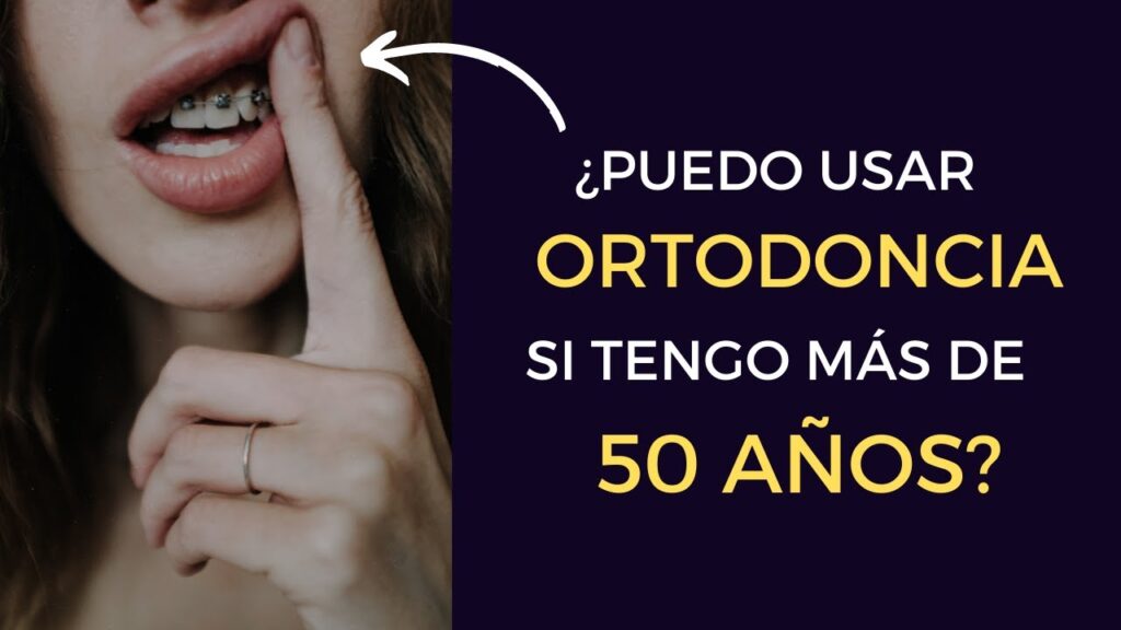 opiniones de hacerse ortodoncia con mas de 50 años