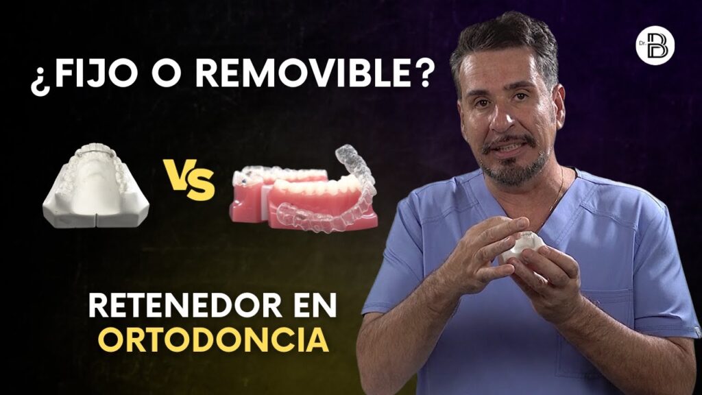 opiniones retenedor fijo o removible ortodoncia