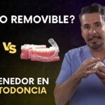 opiniones retenedor fijo o removible ortodoncia