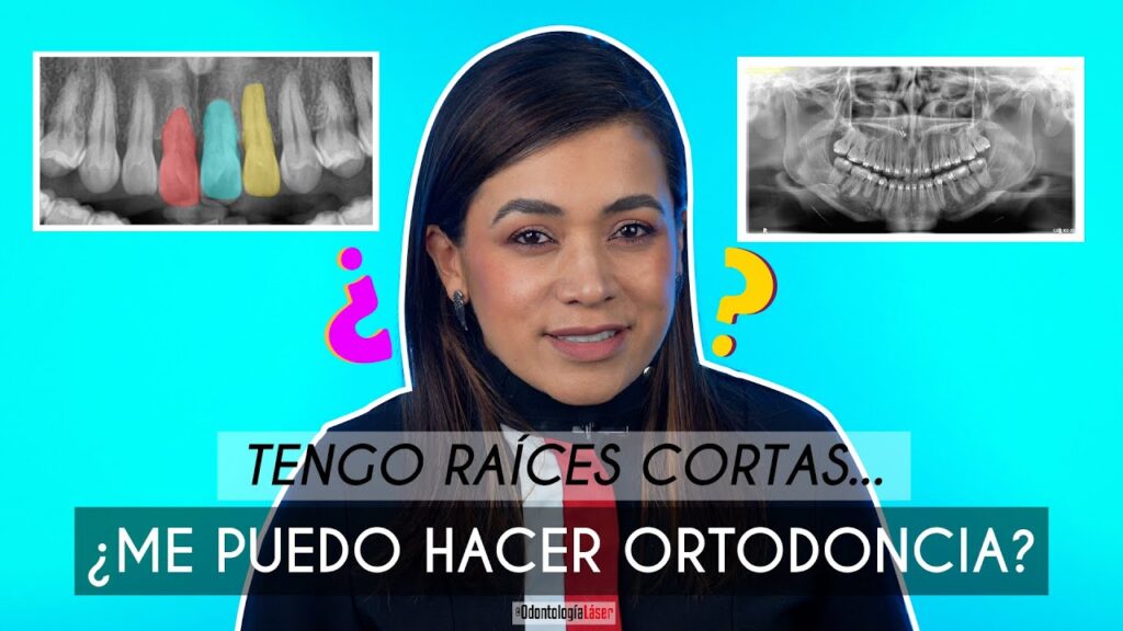 ortodoncia al tener la raíz corta