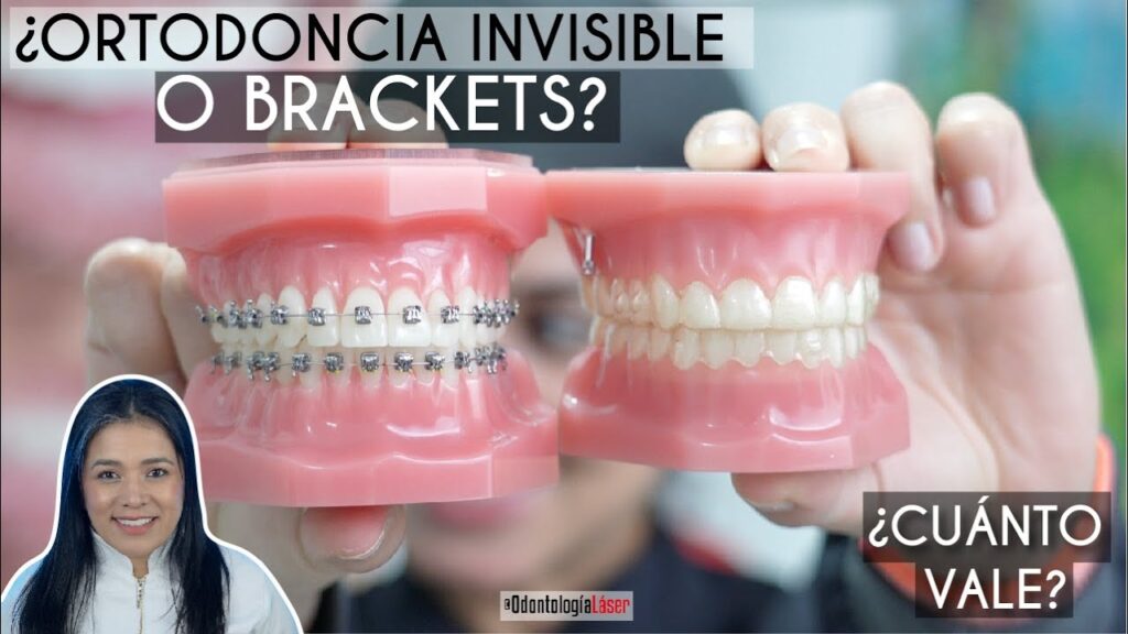 ortodoncia brackets burgos precio