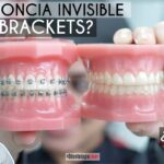 ortodoncia brackets burgos precio