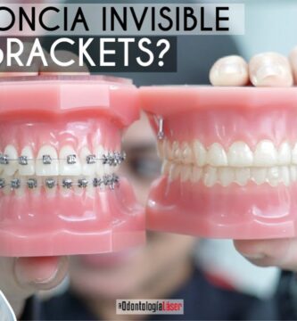 ortodoncia brackets burgos precio