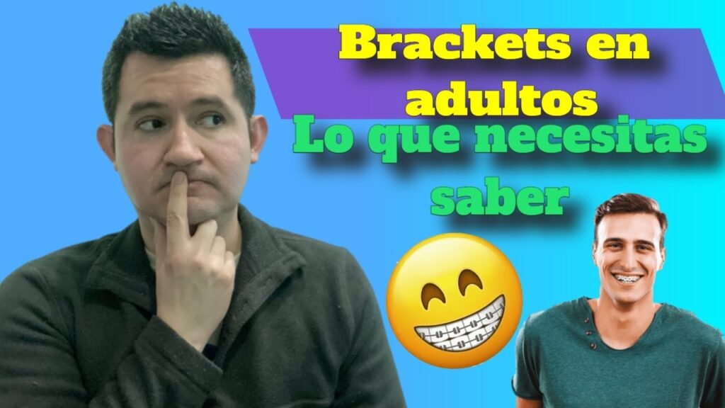 ortodoncia brackets en adultos