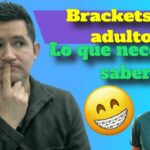 ortodoncia brackets en adultos