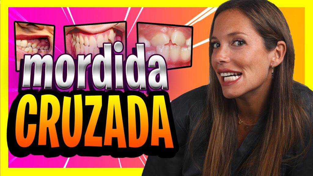 ortodoncia brackets mordida cruzada adulto