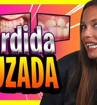 ortodoncia braquet mordida cruzada adulto