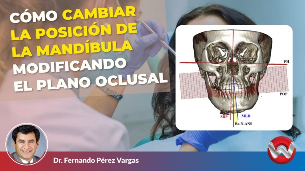 ortodoncia cambio plano oclusal