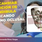 ortodoncia cambio plano oclusal