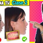 ortodoncia clase 2 dientes grandes