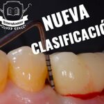 ortodoncia clasificacion de coslet periodoncia